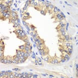 Immunohistochemistry - Anti-KLK10 Antibody (A13629) - Antibodies.com