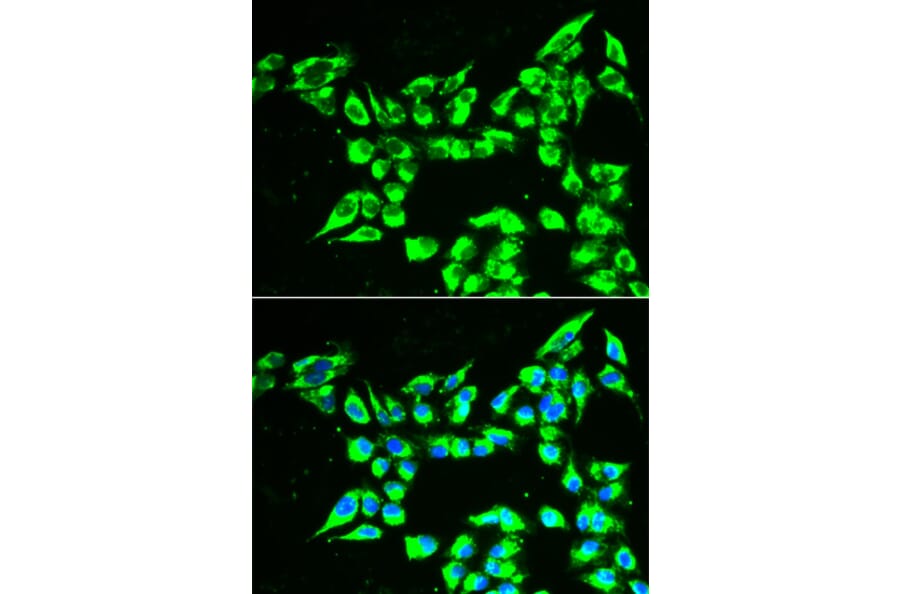 Immunofluorescence - Anti-KLK10 Antibody (A13629) - Antibodies.com