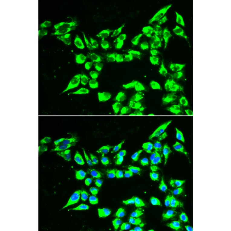 Immunofluorescence - Anti-KLK10 Antibody (A13629) - Antibodies.com