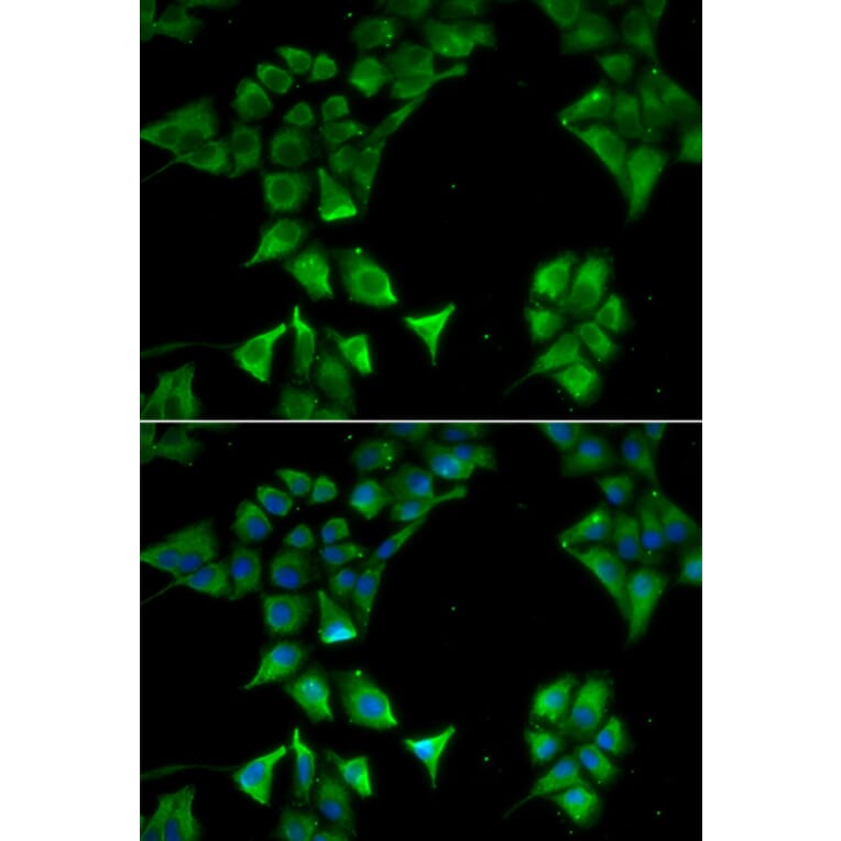 Immunofluorescence - Anti-CD177 Antibody (A13597) - Antibodies.com