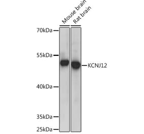 Western Blot - Anti-IRK-2 Antibody (A92383) - Antibodies.com