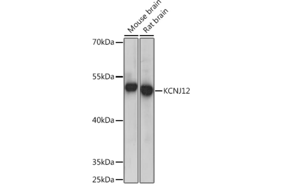 Western Blot - Anti-IRK-2 Antibody (A92383) - Antibodies.com