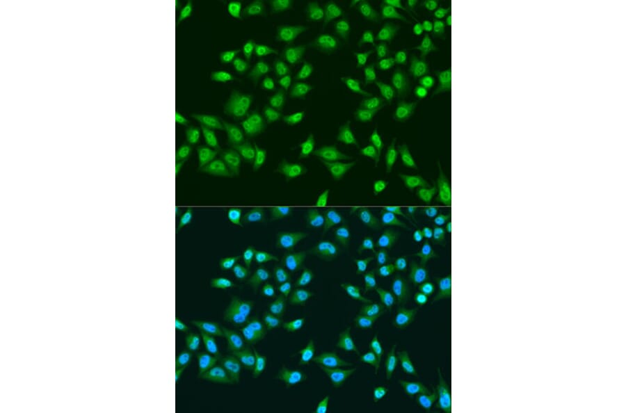 Immunofluorescence - Anti-RPS6KB1 Antibody (A15719) - Antibodies.com