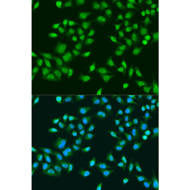 Immunofluorescence - Anti-RPS6KB1 Antibody (A15719) - Antibodies.com