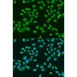 Immunofluorescence - Anti-RPS6KB1 Antibody (A15719) - Antibodies.com