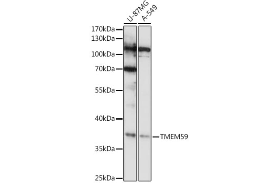 Western Blot - Anti-TMEM59 Antibody (A92385) - Antibodies.com