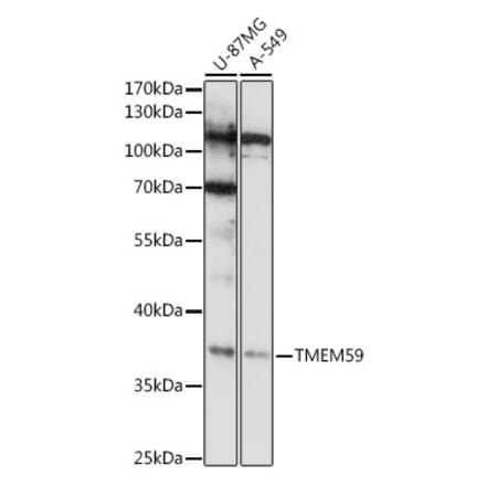 Western Blot - Anti-TMEM59 Antibody (A92385) - Antibodies.com