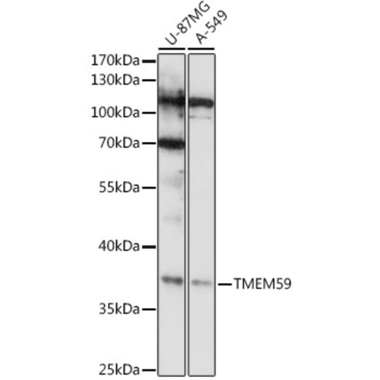 Western Blot - Anti-TMEM59 Antibody (A92385) - Antibodies.com