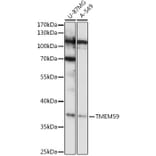 Western Blot - Anti-TMEM59 Antibody (A92385) - Antibodies.com
