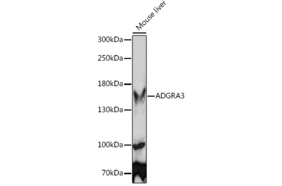 Western Blot - Anti-GPCR GPR125 Antibody (A92391) - Antibodies.com