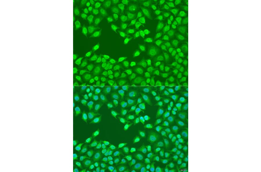 Immunofluorescence - Anti-FZD4 Antibody (A15113) - Antibodies.com