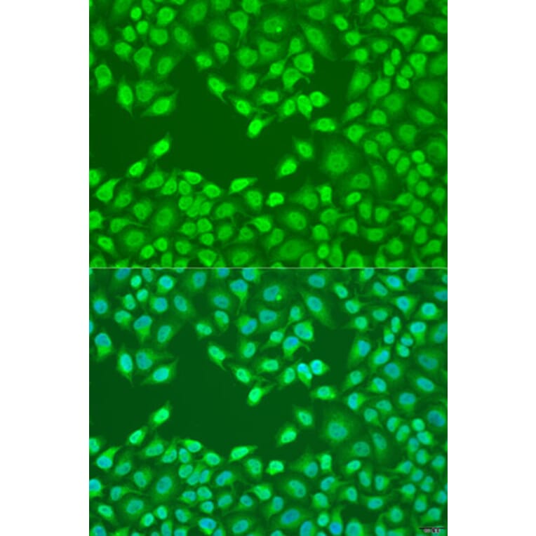 Immunofluorescence - Anti-FZD4 Antibody (A15113) - Antibodies.com