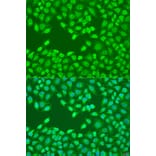 Immunofluorescence - Anti-FZD4 Antibody (A15113) - Antibodies.com