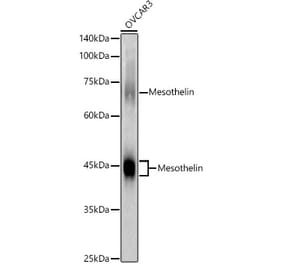 Western Blot - Anti-Mesothelin Antibody (A92393) - Antibodies.com