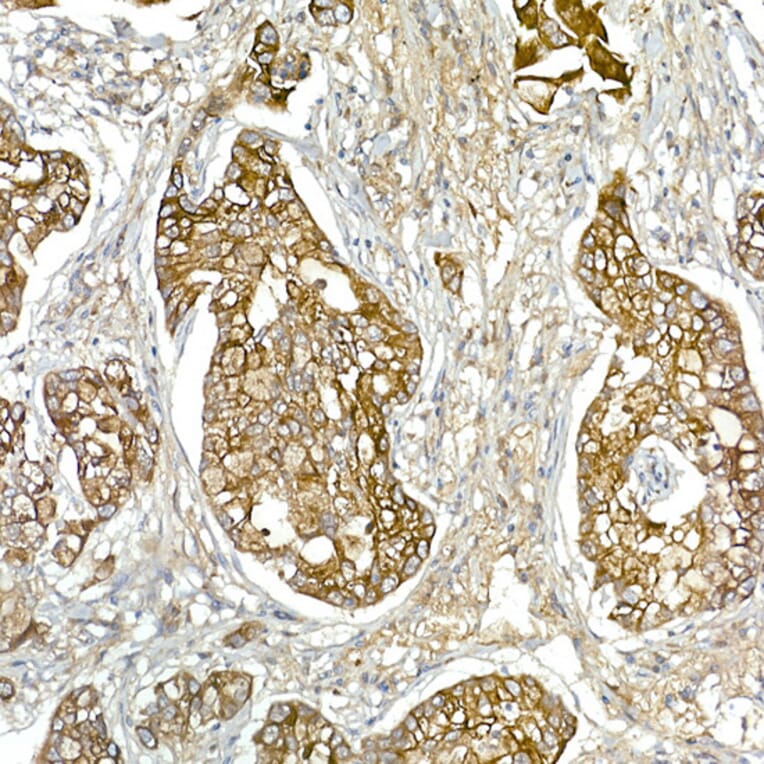 Immunohistochemistry - Anti-Mesothelin Antibody (A92393) - Antibodies.com
