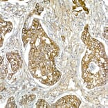 Immunohistochemistry - Anti-Mesothelin Antibody (A92393) - Antibodies.com