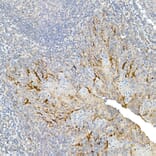 Immunohistochemistry - Anti-Mesothelin Antibody (A92393) - Antibodies.com