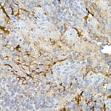 Immunohistochemistry - Anti-Mesothelin Antibody (A92393) - Antibodies.com