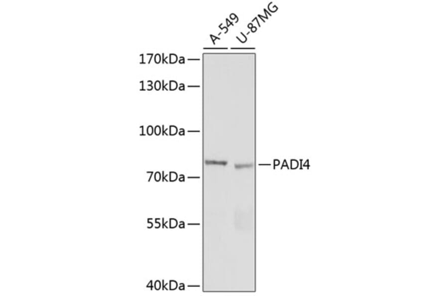 Western Blot - Anti-PADI4/PAD4 Antibody (A92394) - Antibodies.com