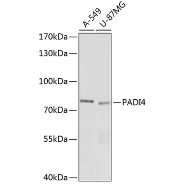 Western Blot - Anti-PADI4/PAD4 Antibody (A92394) - Antibodies.com