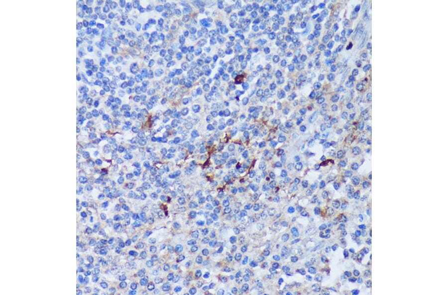 Immunohistochemistry - Anti-PADI4/PAD4 Antibody (A92394) - Antibodies.com