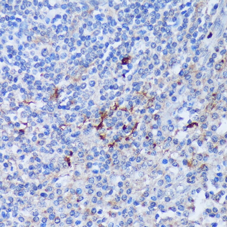 Immunohistochemistry - Anti-PADI4/PAD4 Antibody (A92394) - Antibodies.com