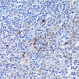 Immunohistochemistry - Anti-PADI4/PAD4 Antibody (A92394) - Antibodies.com