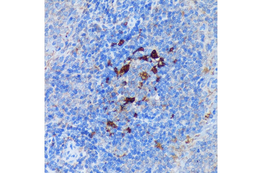 Immunohistochemistry - Anti-PADI4/PAD4 Antibody (A92394) - Antibodies.com