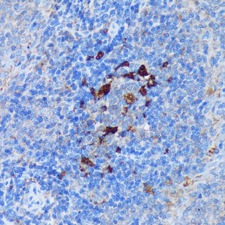 Immunohistochemistry - Anti-PADI4/PAD4 Antibody (A92394) - Antibodies.com