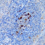 Immunohistochemistry - Anti-PADI4/PAD4 Antibody (A92394) - Antibodies.com
