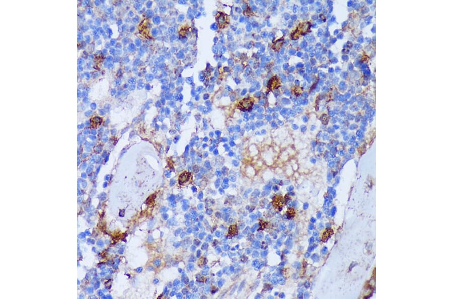 Immunohistochemistry - Anti-PADI4/PAD4 Antibody (A92394) - Antibodies.com