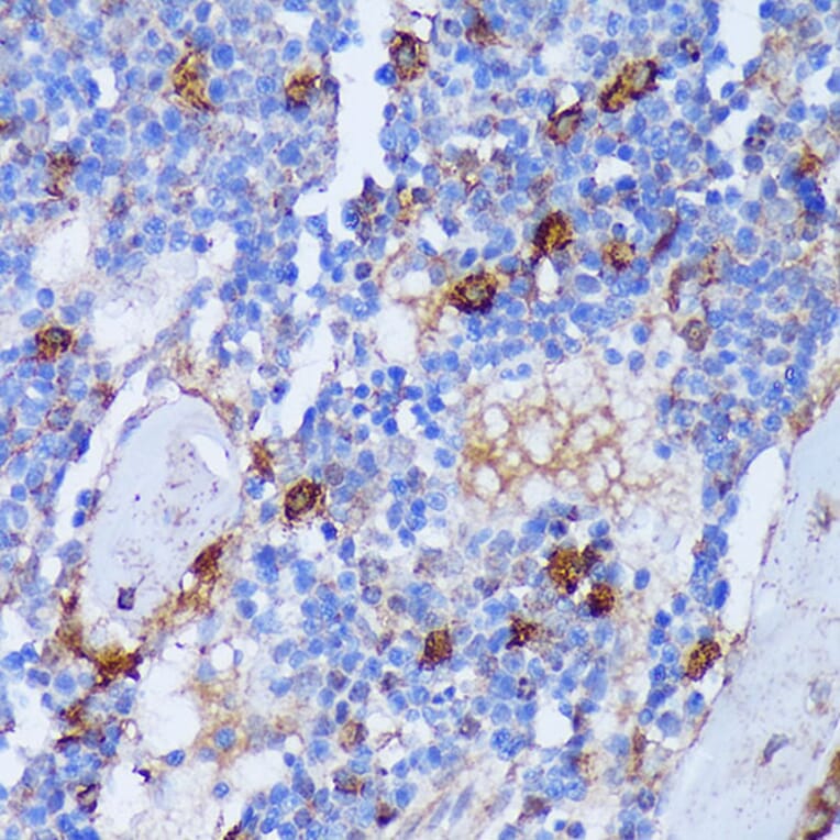 Immunohistochemistry - Anti-PADI4/PAD4 Antibody (A92394) - Antibodies.com