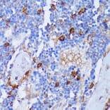 Immunohistochemistry - Anti-PADI4/PAD4 Antibody (A92394) - Antibodies.com