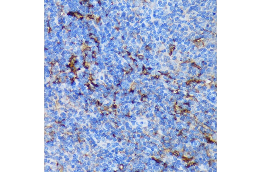 Immunohistochemistry - Anti-PADI4/PAD4 Antibody (A92394) - Antibodies.com