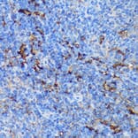 Immunohistochemistry - Anti-PADI4/PAD4 Antibody (A92394) - Antibodies.com