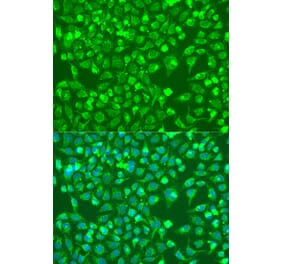 Immunofluorescence - Anti-BMP6 Antibody (A92395) - Antibodies.com