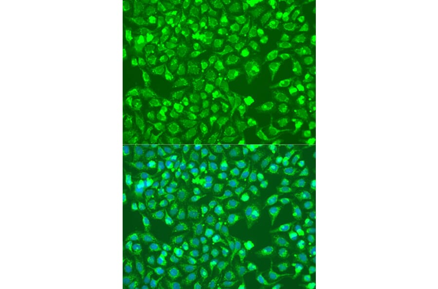 Immunofluorescence - Anti-BMP6 Antibody (A92395) - Antibodies.com