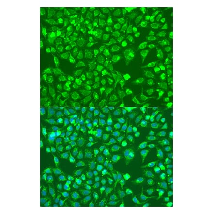 Immunofluorescence - Anti-BMP6 Antibody (A92395) - Antibodies.com
