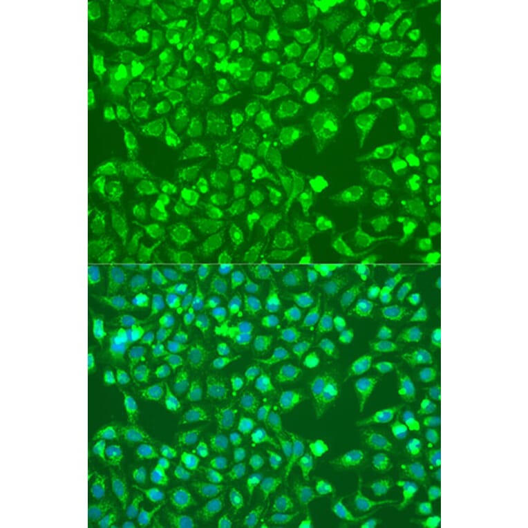 Immunofluorescence - Anti-BMP6 Antibody (A92395) - Antibodies.com