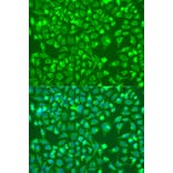 Immunofluorescence - Anti-BMP6 Antibody (A92395) - Antibodies.com