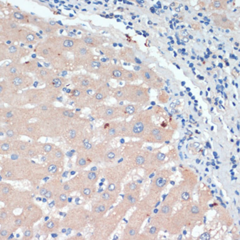 Immunohistochemistry - Anti-Dopamine beta Hydroxylase Antibody (A92397) - Antibodies.com