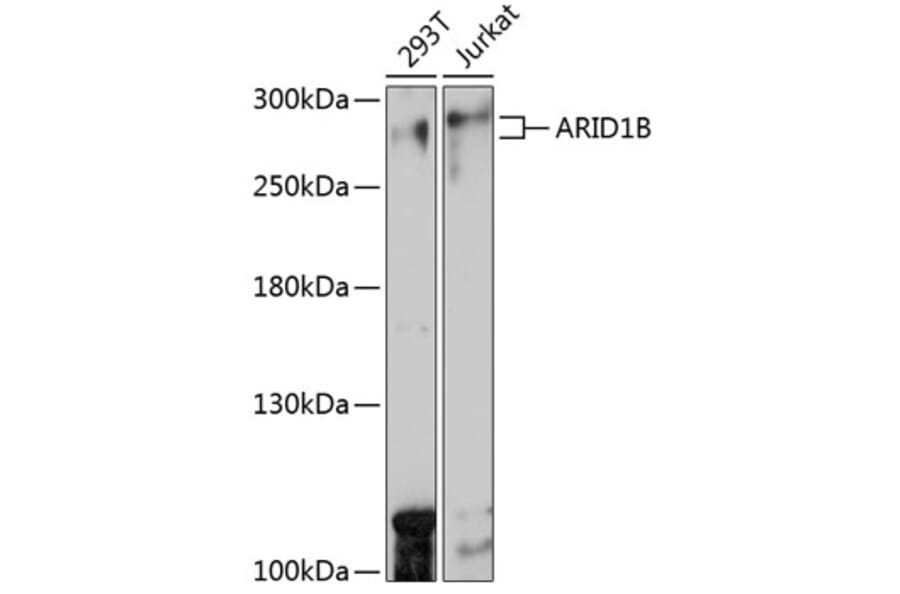 Western Blot - Anti-ARID1B Antibody (A92400) - Antibodies.com