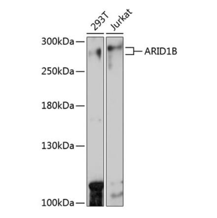 Western Blot - Anti-ARID1B Antibody (A92400) - Antibodies.com