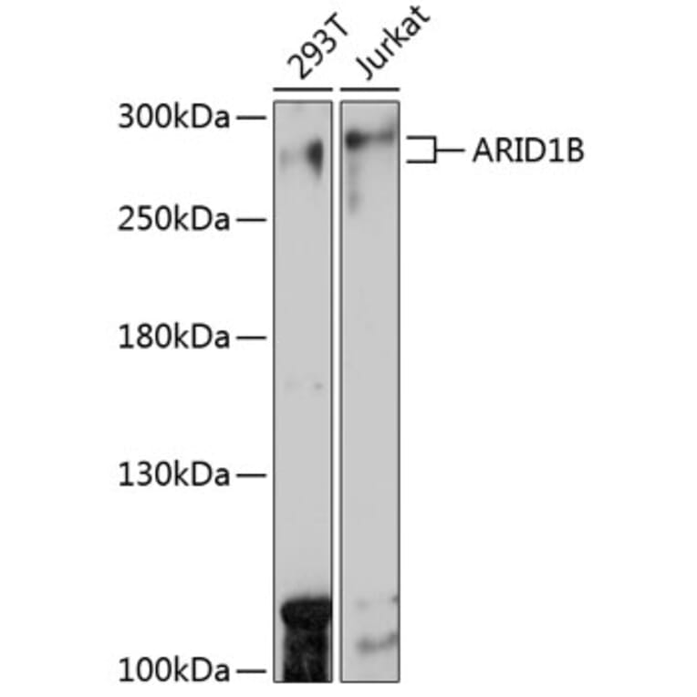 Western Blot - Anti-ARID1B Antibody (A92400) - Antibodies.com