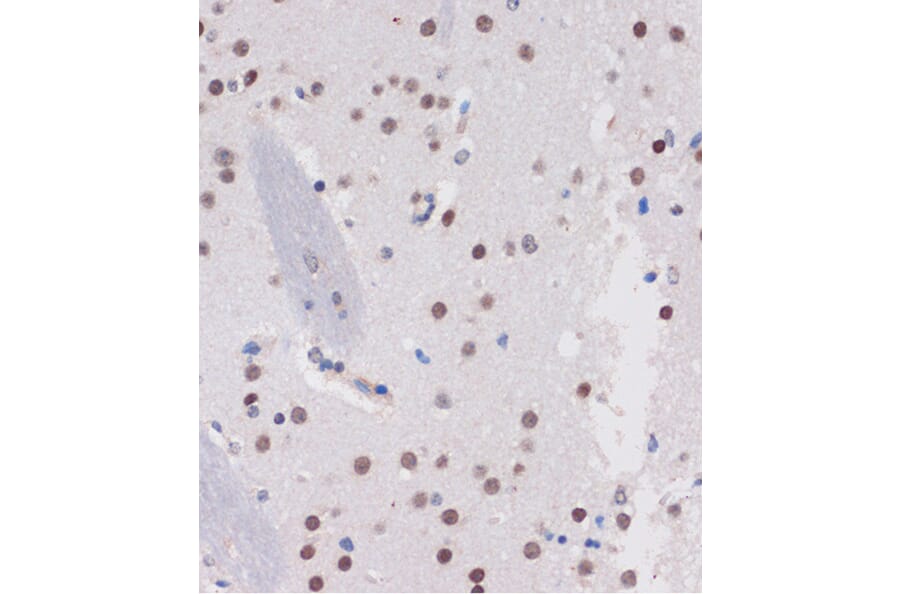 Immunohistochemistry - Anti-ARID1B Antibody (A92400) - Antibodies.com