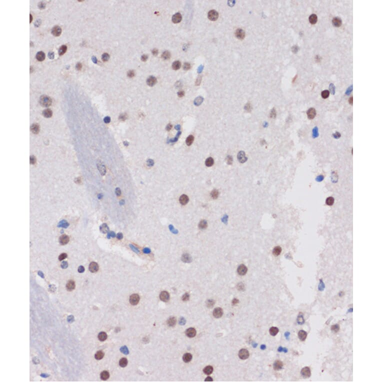 Immunohistochemistry - Anti-ARID1B Antibody (A92400) - Antibodies.com