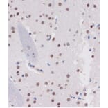 Immunohistochemistry - Anti-ARID1B Antibody (A92400) - Antibodies.com