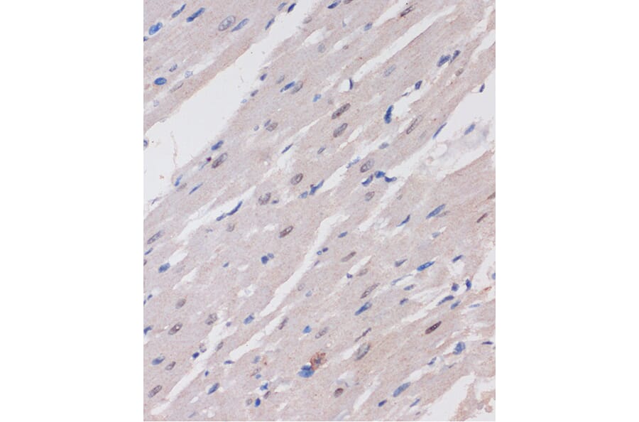 Immunohistochemistry - Anti-ARID1B Antibody (A92400) - Antibodies.com