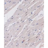 Immunohistochemistry - Anti-ARID1B Antibody (A92400) - Antibodies.com