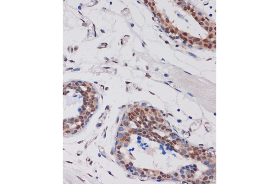 Immunohistochemistry - Anti-ARID1B Antibody (A92400) - Antibodies.com